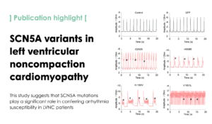 Cellular-level analyses of SCN5A mutations in left ventricular noncompaction cardiomyopathy suggest electrophysiological mechanisms for ventricular tachycardia